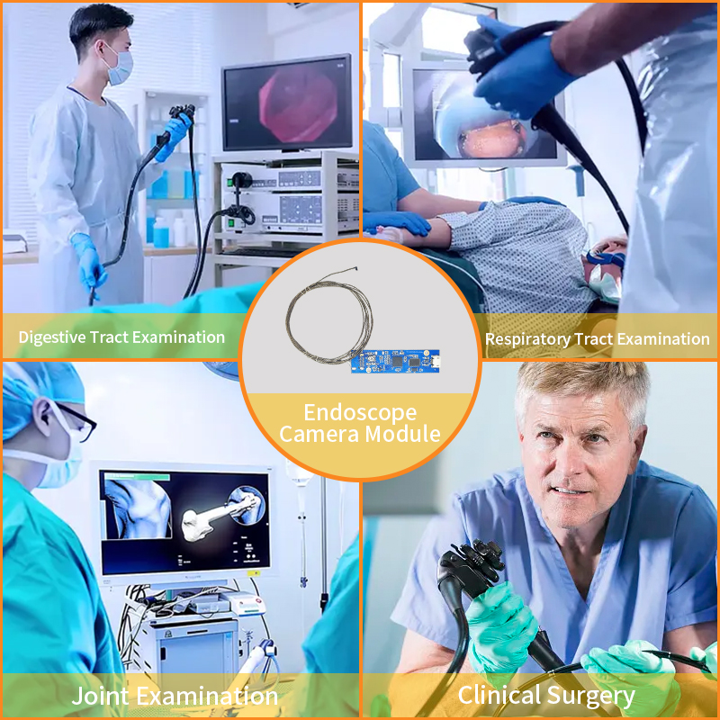 Vue lat&eacute;rale et interface USB&nbsp;: une analyse des avantages d'application pratique du module de cam&eacute;ra endoscopique