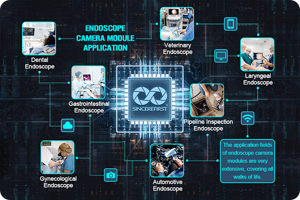Applicazione del modulo telecamera per endoscopio
