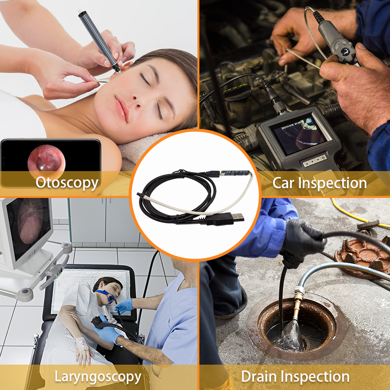 Quali sono le differenze nell'applicazione dei moduli telecamera per endoscopio in campo medico e industriale?