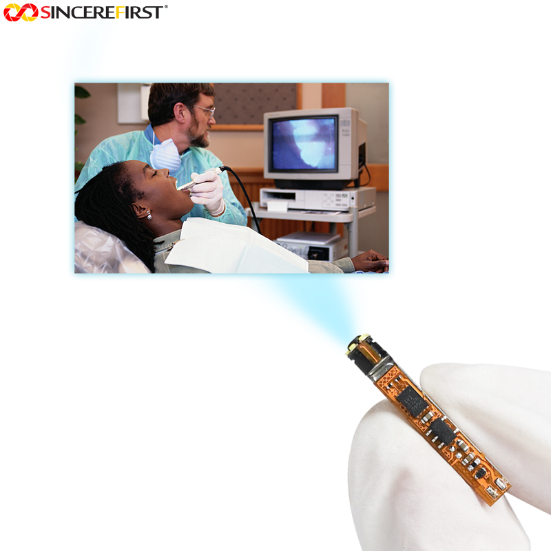 Pourquoi les perles LED devraient-elles &ecirc;tre int&eacute;gr&eacute;es au module de cam&eacute;ra de l'endoscope&nbsp;?